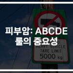 ‘피부암과 점 구별법과 구분하는 방법’… 간과하기 쉬운 ABCDE 체크 포인트