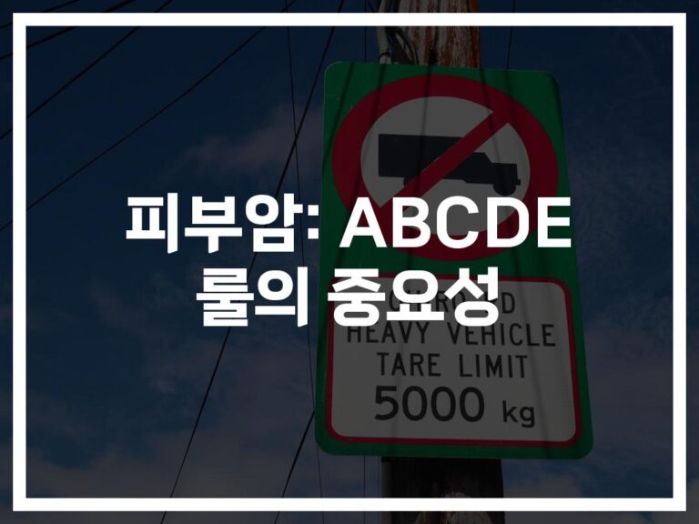 ‘피부암과 점 구별법과 구분하는 방법’… 간과하기 쉬운 ABCDE 체크 포인트